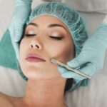 Things You Should Prepare Before Using a Micro Needling Device