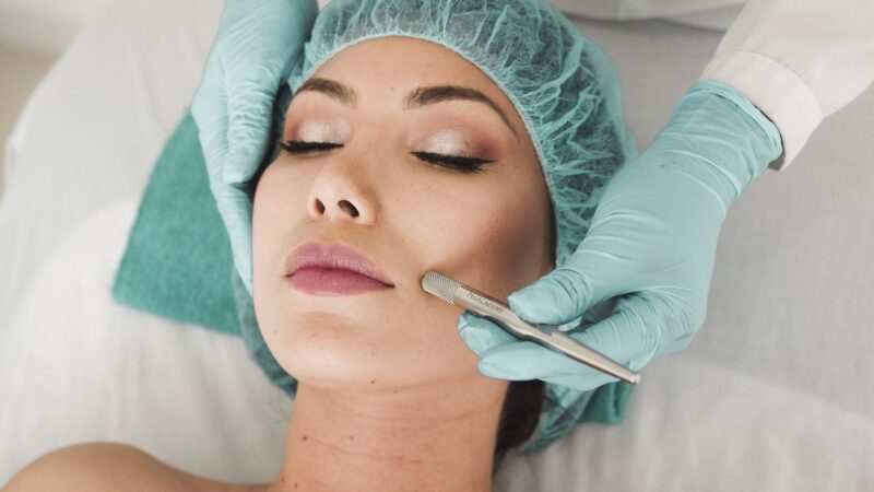 Things You Should Prepare Before Using a Micro Needling Device